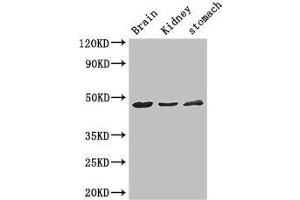 Western Blot Positive WB detected in: Mouse brain tissue, Mouse kidney tissue, Mouse stomach tissue All lanes: AGK antibody at 3 μg/mL Secondary Goat polyclonal to rabbit IgG at 1/50000 dilution Predicted band size: 48, 8 kDa Observed band size: 48 kDa (Acylglycerol Kinase anticorps  (AA 32-65))