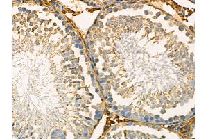 ABIN6259606 and ABIN6274170 at 1/100 staining Rat testis tissue by IHC-P.