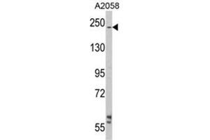 Western blot analysis of LAMB2 Antibody (C-term) in A2058 cell line lysates (35ug/lane).