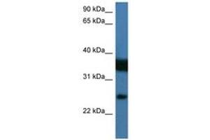 Image no. 1 for anti-Zinc Finger, Matrin Type 2 (ZMAT2) (AA 25-74) antibody (ABIN6746195)