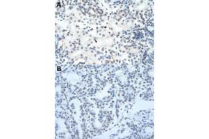 Immunohistochemical staining (Formalin-fixed paraffin-embedded sections) of human kidney (A) and human lung (B) with HNRNPH3 polyclonal antibody  at 4-8 ug/mL working concentration.