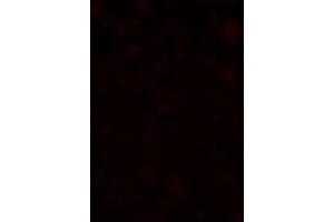 anti-SLAIN Motif Family, Member 1 (SLAIN1) (C-Term) antibody