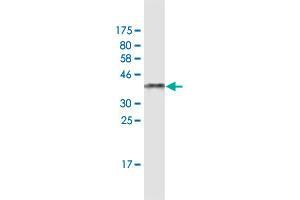 Western Blot detection against Immunogen (38.