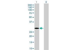 Lane 1: TERF2 transfected lysate ( 28.