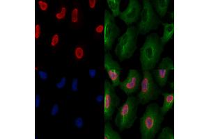 ABIN6261257 and ABIN6277502 staining  cells by IF/ICC. (DDX5 anticorps  (C-Term))