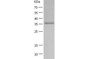Western Blotting (WB) image for Branched Chain Amino-Acid Transaminase 2, Mitochondrial (BCAT2) (AA 28-392) protein (His-IF2DI Tag) (ABIN7122028)