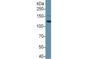 Rabbit Capture antibody from the kit in WB with Positive Control:  Mouse Serum. (LIFR Kit ELISA)