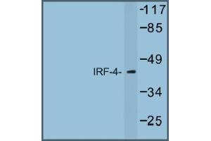 Image no. 1 for anti-Interferon Regulatory Factor 4 (IRF4) antibody (ABIN317672) (IRF4 anticorps)