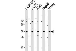 All lanes : Anti-RCN3 Antibody (Center) at 1:2000 dilution Lane 1: U-251 MG whole cell lysate Lane 2: U-2OS whole cell lysate Lane 3: A549 whole cell lysate Lane 4: HepG2 whole cell lysate Lane 5: Mouse lung lysate Lysates/proteins at 20 μg per lane. (RCN3 anticorps  (AA 134-163))