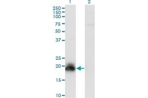 Western Blot analysis of HAND2 expression in transfected 293T cell line by HAND2 monoclonal antibody (M09), clone 2C10. (HAND2 anticorps  (AA 135-216))