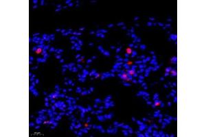 Immunofluorescence of paraffin embedded rat lung using SIX1 (ABIN7075617) at dilution of 1: 650 (400x lens) (SIX Homeobox 1 anticorps)