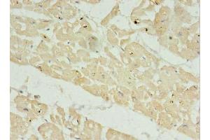 Immunohistochemistry of paraffin-embedded human heart tissue using ABIN7165422 at dilution of 1:100 (FAM156A anticorps  (AA 1-153))