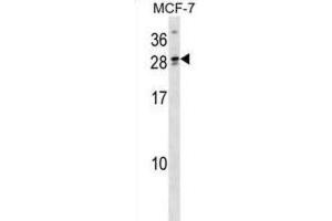 Western Blotting (WB) image for anti-Lipoyl(octanoyl) Transferase 2 (Putative) (LIPT2) antibody (ABIN3000020)