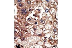 Image no. 2 for anti-Epidermal Growth Factor Receptor Pathway Substrate 8 (EPS8) (N-Term) antibody (ABIN360658) (EPS8 anticorps  (N-Term))