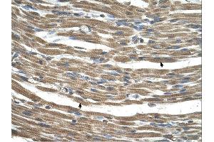 Immunohistochemistry (IHC) image for anti-Chromosome 21 Open Reading Frame 33 (C21orf33) (N-Term) antibody (ABIN2782372)