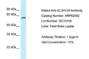 Western Blotting (WB) image for anti-Zinc Finger CCCH-Type Containing 12A (ZC3H12A) (C-Term) antibody (ABIN2789180) (ZC3H12A anticorps  (C-Term))