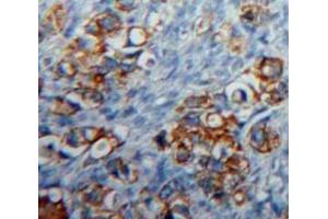 IHC-P analysis of Ovary tissue, with DAB staining. (CD83 anticorps  (AA 24-205))