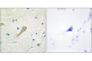 Immunohistochemistry analysis of paraffin-embedded human brain tissue, using SEMA4A Antibody. (Sema4a anticorps  (AA 501-550))