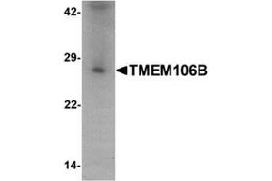 TMEM106B anticorps  (N-Term)