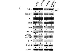 PKD1 impaired osteoblast differentiation through JAK1/STAT3 and p38 signaling pathway.