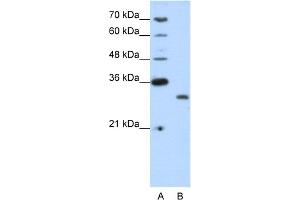 WB Suggested Anti-CPXCR1 Antibody Titration:  1. (CPXCR1 anticorps  (N-Term))