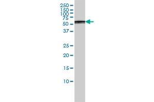 PSMD5 monoclonal antibody (M01), clone 3E2 Western Blot analysis of PSMD5 expression in A-431 .