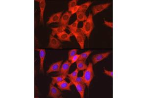 Immunofluorescence analysis of NIH/3T3 cells using S6 Ribosomal Protein (RPS6) Rabbit pAb (ABIN6133901, ABIN6147227, ABIN6147228 and ABIN6221687) at dilution of 1:100 (40x lens).