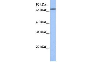 WB Suggested Anti-GK2 Antibody Titration: 0. (GK2 anticorps  (C-Term))