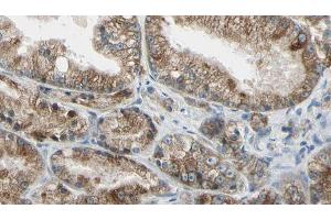 ABIN6273991 at 1/100 staining Human prostate tissue by IHC-P.