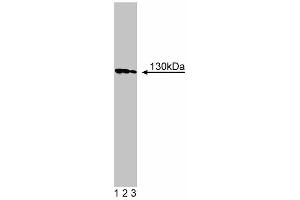 Western blot analysis of Cadherin-5 on human endothelial cell lysate. (Cadherin 5 anticorps  (AA 26-194))