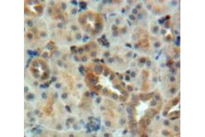 Used in DAB staining on fromalin fixed paraffin-embedded Kidney tissue (BMP7 anticorps  (AA 30-431))