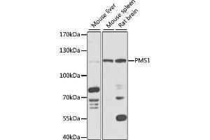 Western blot analysis of extracts of various cell lines, using PMS1 antibody (ABIN6128473, ABIN6145826, ABIN6145827 and ABIN6218265) at 1:1000 dilution. (PMS1 anticorps  (AA 405-619))