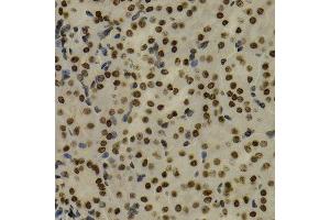 Immunohistochemistry of paraffin-embedded mouse kidney using NFKB2 Antibody.