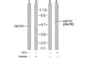 Image no. 1 for anti-GATA Binding Protein 1 (Globin Transcription Factor 1) (GATA1) (Ser310) antibody (ABIN197170) (GATA1 anticorps  (Ser310))