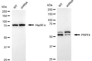 Western blotting analysis using PRPF4 antibody (ABIN7800056).