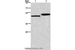 Western blot analysis of Human stomach cancer and mouse stomach tissue, using CTSE Polyclonal Antibody at dilution of 1:450 (Cathepsin E anticorps)