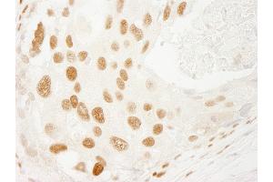Immunohistochemistry (IHC) image for anti-Promyelocytic Leukemia (PML) (AA 375-425) antibody (ABIN7448728)