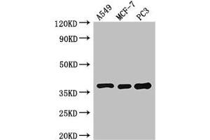Western Blot Positive WB detected in: A549 whole cell lysate, MCF-7 whole cell lysate, PC-3 whole cell lysate All lanes: SLC9A3R2 antibody at 3 μg/mL Secondary Goat polyclonal to rabbit IgG at 1/50000 dilution Predicted band size: 38, 37, 25 kDa Observed band size: 38 kDa