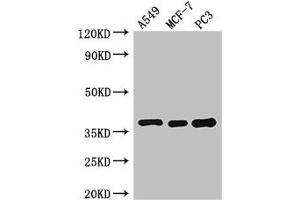 Western Blot Positive WB detected in: A549 whole cell lysate, MCF-7 whole cell lysate, PC-3 whole cell lysate All lanes: SLC9A3R2 antibody at 3 μg/mL Secondary Goat polyclonal to rabbit IgG at 1/50000 dilution Predicted band size: 38, 37, 25 kDa Observed band size: 38 kDa (SLC9A3R2 anticorps  (AA 106-313))