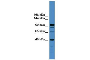 WB Suggested Anti-IFT88 Antibody Titration: 0.