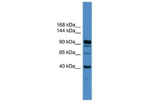 WB Suggested Anti-IFT88 Antibody Titration: 0. (IFT88 anticorps  (Middle Region))