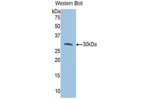 Western Blotting (WB) image for anti-VAMP (Vesicle-Associated Membrane Protein)-Associated Protein A, 33kDa (VAPA) (AA 1-249) antibody (ABIN1078660) (VAPA anticorps  (AA 1-249))