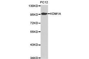 Western Blotting (WB) image for anti-Lysine (K)-Specific Demethylase 1A (KDM1A) antibody (ABIN1873389)