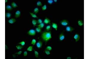 Immunofluorescence staining of Hela cells with ABIN7146862 at 1:266, counter-stained with DAPI. (CK1 epsilon anticorps  (Isoform epsilon))