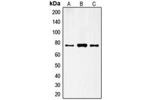 Western blot analysis of FSHR expression in HeLa (A), A431 (B), H1299 (C) whole cell lysates. (FSHR anticorps  (Center))