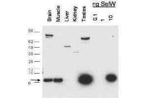 Western blot using  anti-SelW antibody shows detection of endogenous SelW in mouse brain, muscle and testes lysates. (Selenoprotein W anticorps)
