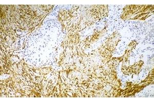 Image no. 1 for anti-Vimentin (VIM) antibody (ABIN335382)