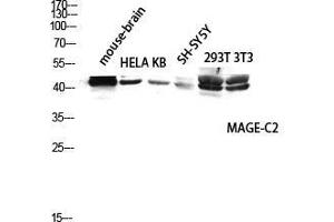 Western Blot (WB) analysis of Mouse Brain HeLa KB SH-SY5Y 293T 3T3 lysis using MAGE-C2 antibody. (MAGEC2 anticorps  (Internal Region))