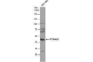 WB Image ST3GAL5 antibody detects ST3GAL5 protein by western blot analysis. (ST3GAL5 anticorps)