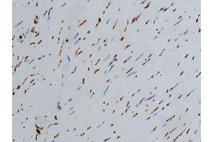ABIN6267568 at 1/200 staining human colon tissue sections by IHC-P.